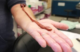 This Worm Was Chilling in a Lab for Years. Turns Out It is a Document-Breaker